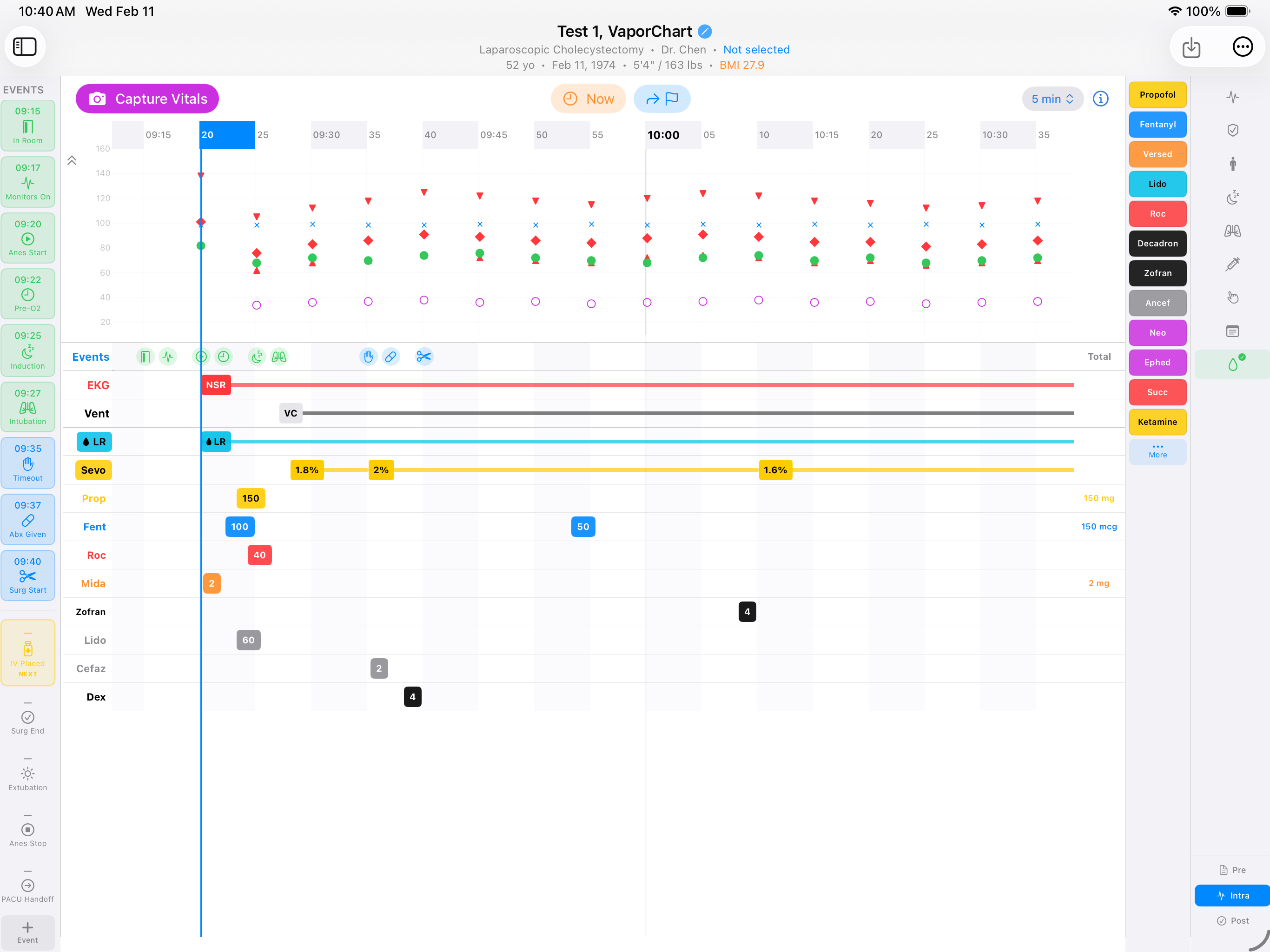 Real-time anesthesia time grid with vitals and medications