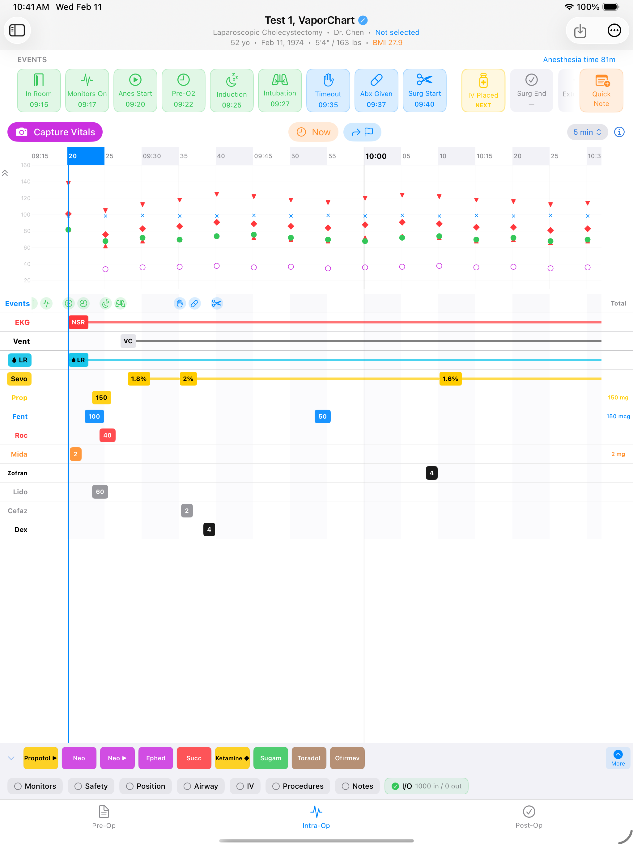 One-tap milestone events on the anesthesia timeline