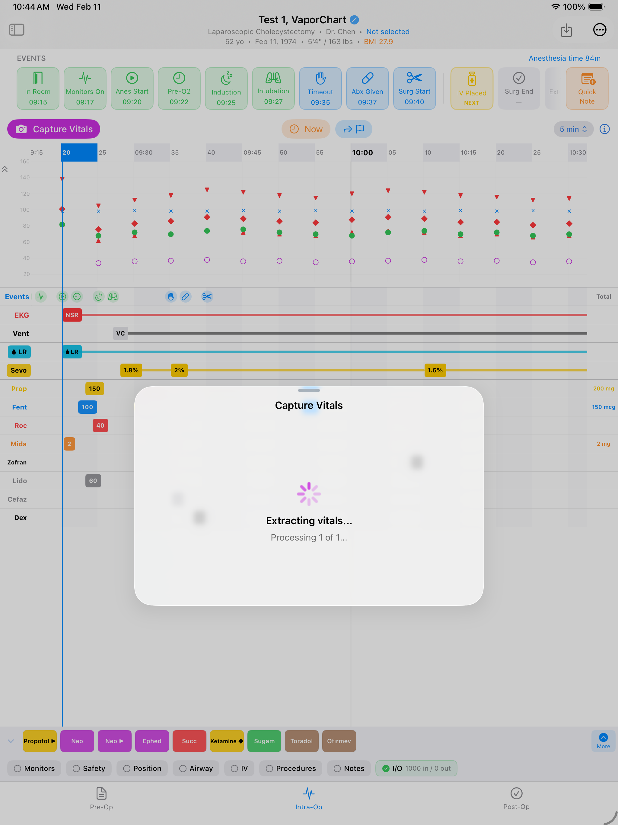 AI-powered vital sign extraction from patient monitor